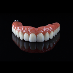 Phục hình toàn hàm Implant